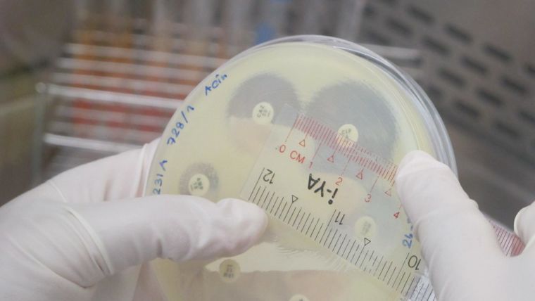 Scientist measuring size of a bacteria colony in a petri dish