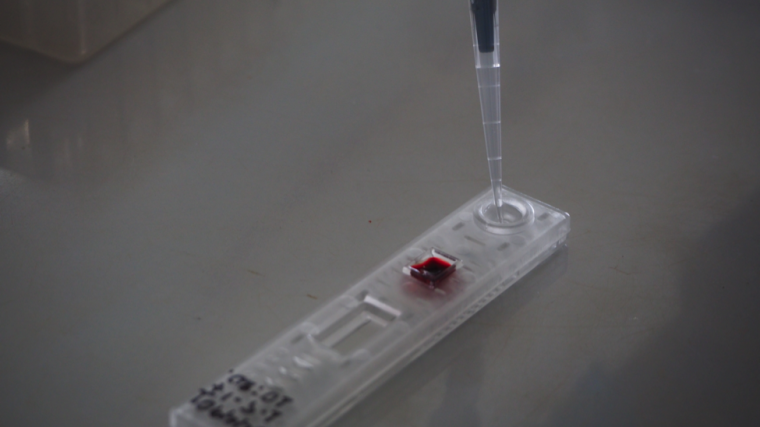 Close-up of malaria rapid blood test